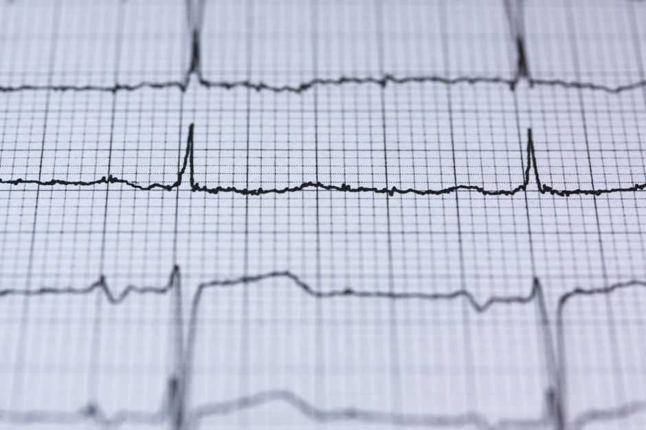 Logo for Bihar BTSC ECG Technician Final Result 2026 Released – Check Merit List & Download PDF
